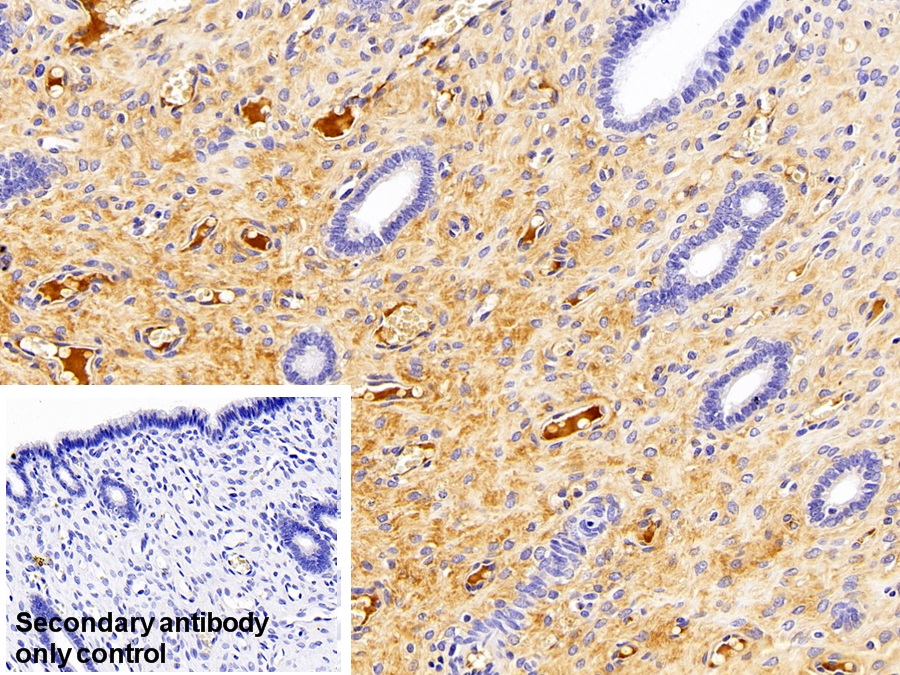 Monoclonal Antibody to Immunoglobulin G (IgG)