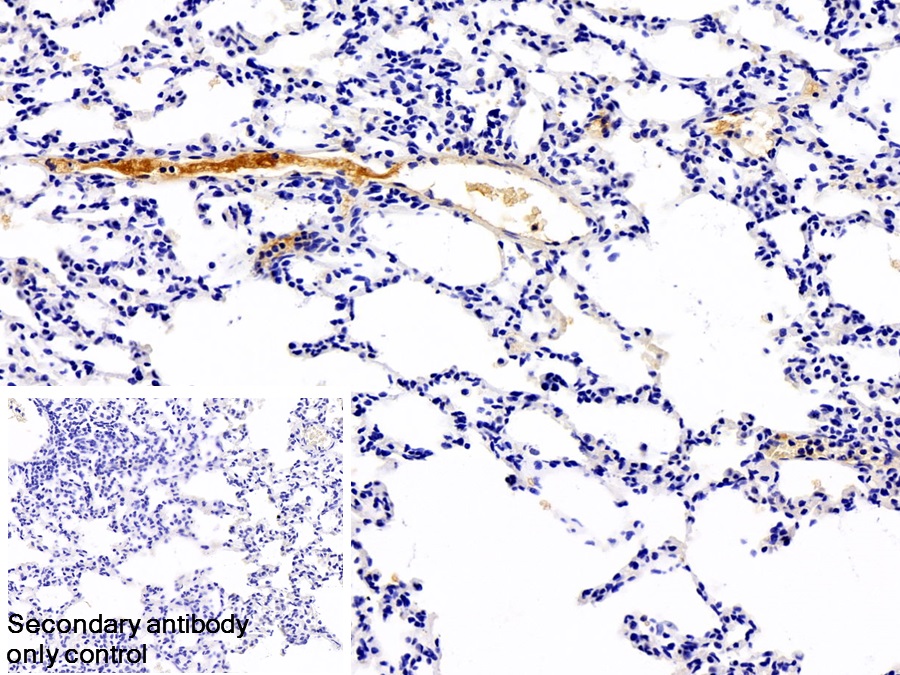 Monoclonal Antibody to Immunoglobulin G (IgG)