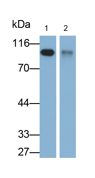 Monoclonal Antibody to Intercellular Adhesion Molecule 1 (ICAM1)