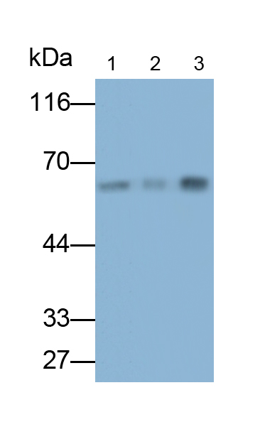 Monoclonal Antibody to Cytokeratin 9 (CK9)