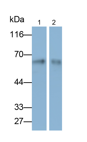 Monoclonal Antibody to Cytokeratin 9 (CK9)