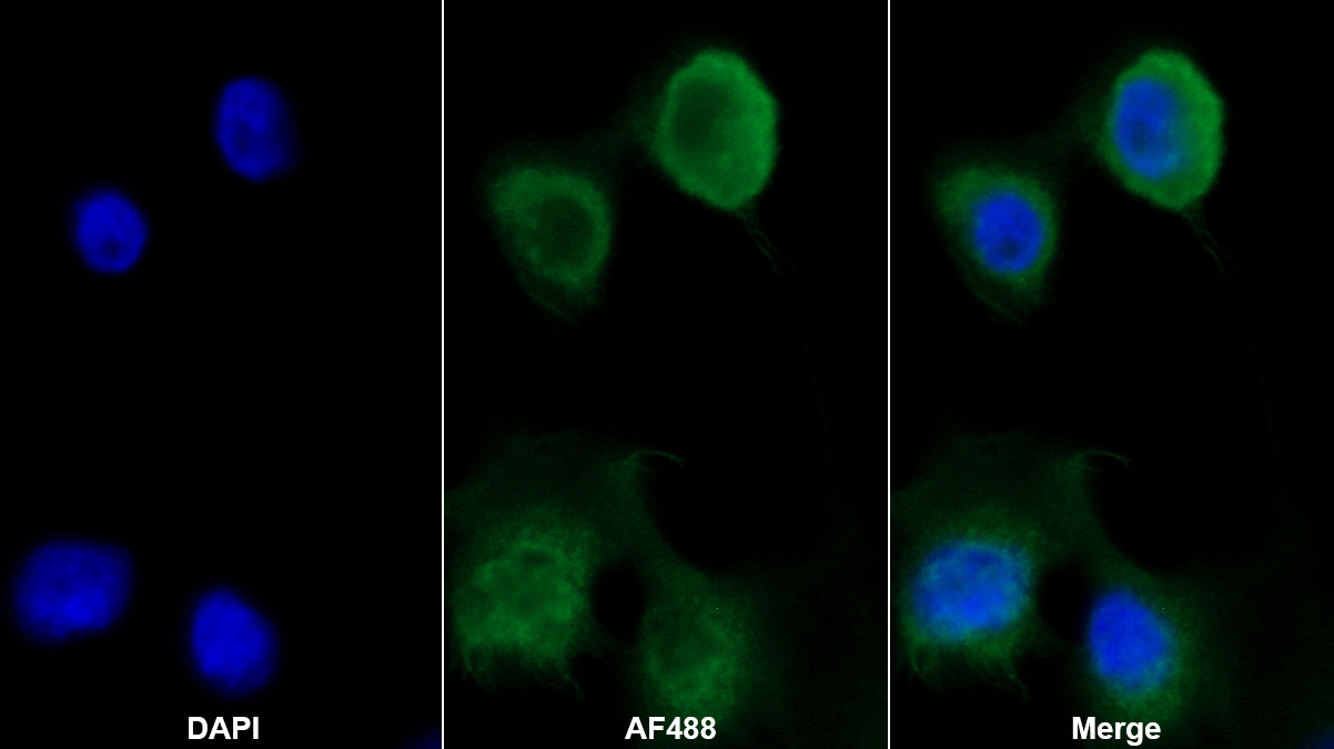 Monoclonal Antibody to Matrix Metalloproteinase 9 (MMP9)
