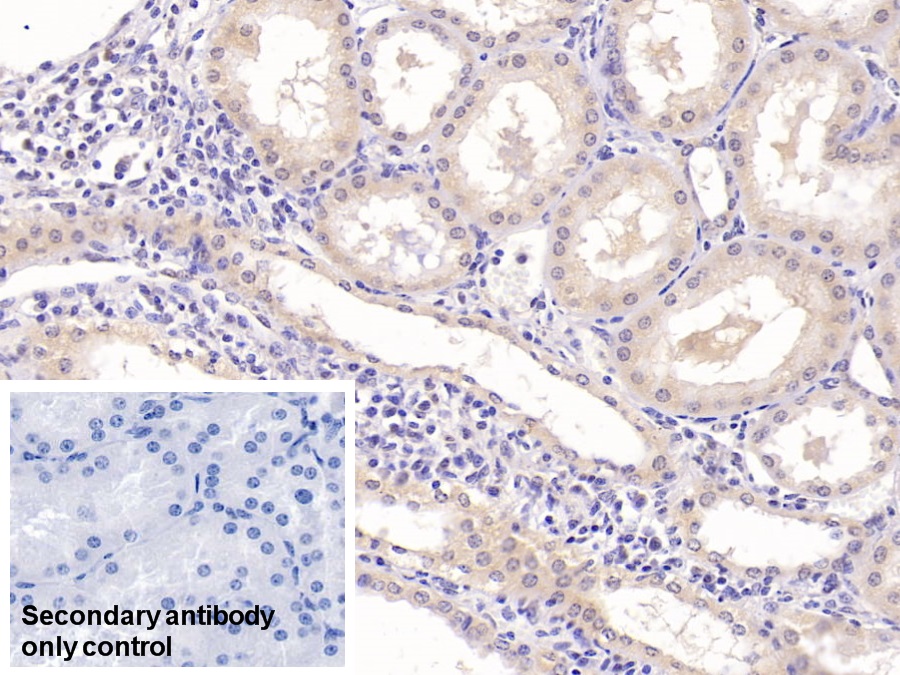 Monoclonal Antibody to Epidermal Growth Factor (EGF)