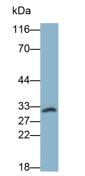 Monoclonal Antibody to Interleukin 1 Beta (IL1b)