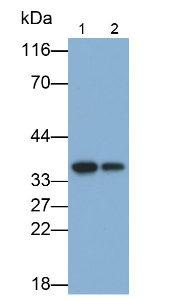 Monoclonal Antibody to Interleukin 1 Beta (IL1b)