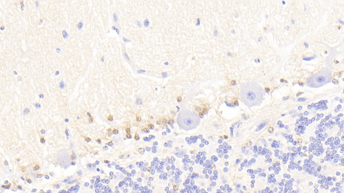 Monoclonal Antibody to S100 Calcium Binding Protein B (S100B)