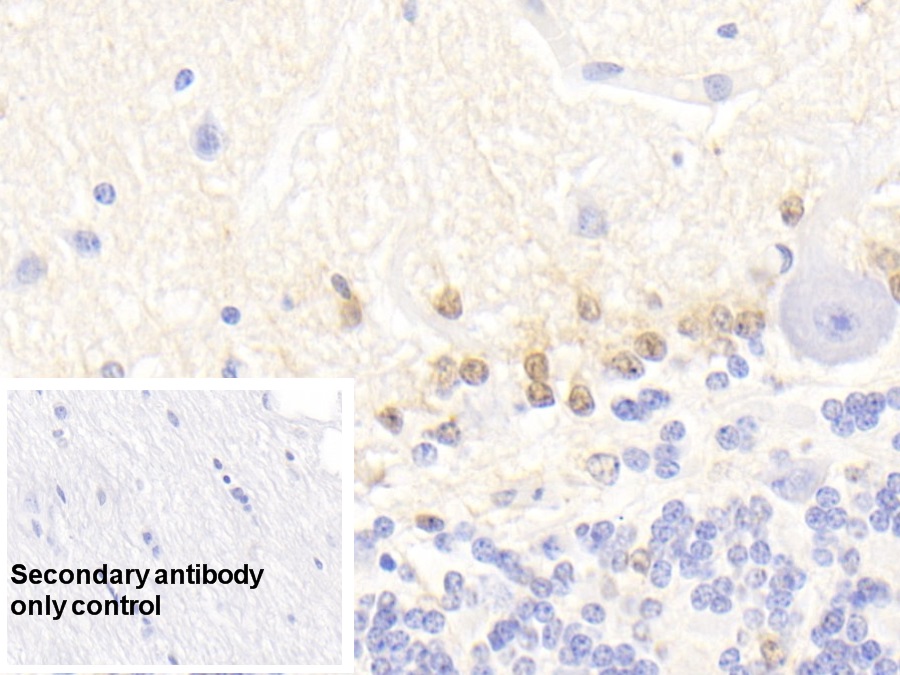 Monoclonal Antibody to S100 Calcium Binding Protein B (S100B)