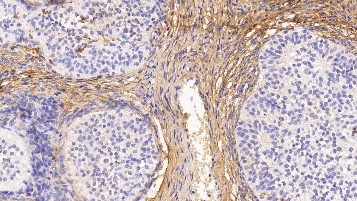 Monoclonal Antibody to Procollagen III N-Terminal Propeptide (PIIINP)