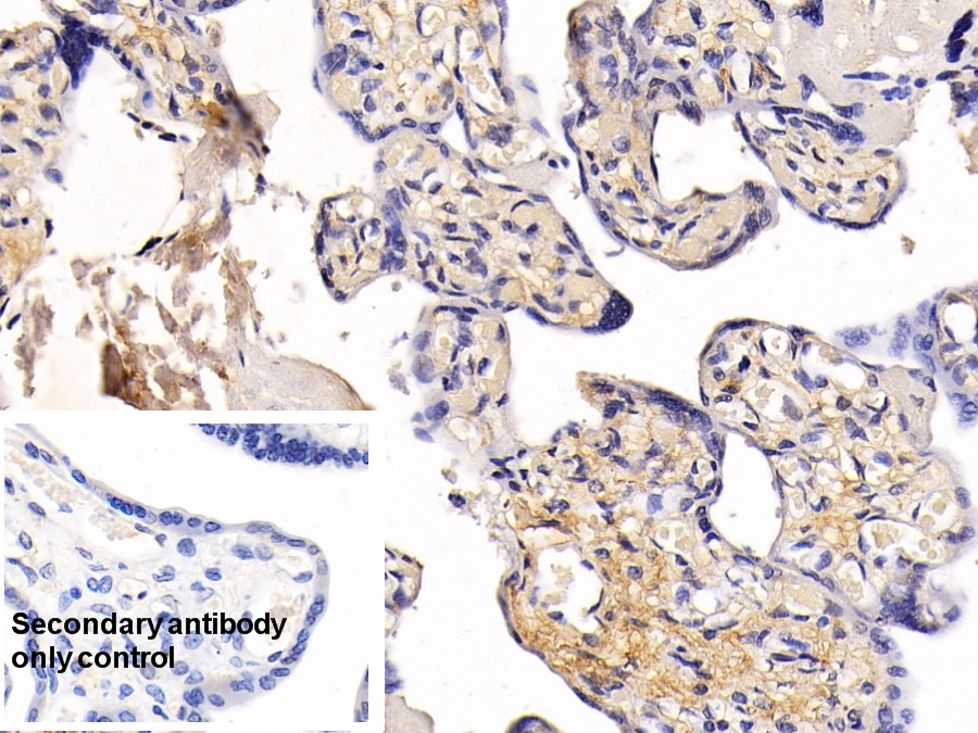 Monoclonal Antibody to Procollagen III N-Terminal Propeptide (PIIINP)