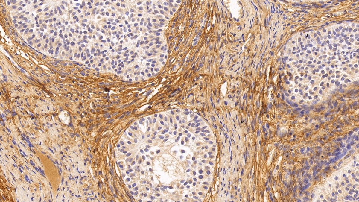 Monoclonal Antibody to Procollagen III N-Terminal Propeptide (PIIINP)