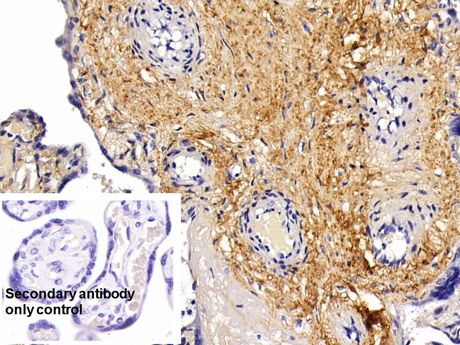 Monoclonal Antibody to Procollagen III N-Terminal Propeptide (PIIINP)