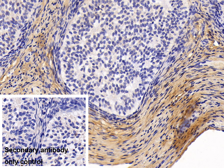 Monoclonal Antibody to Procollagen III N-Terminal Propeptide (PIIINP)
