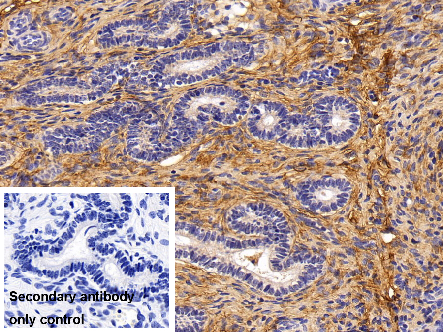 Monoclonal Antibody to Procollagen III N-Terminal Propeptide (PIIINP)