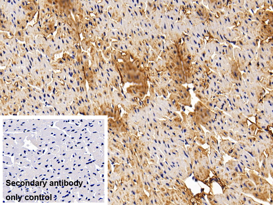 Monoclonal Antibody to Procollagen III N-Terminal Propeptide (PIIINP)