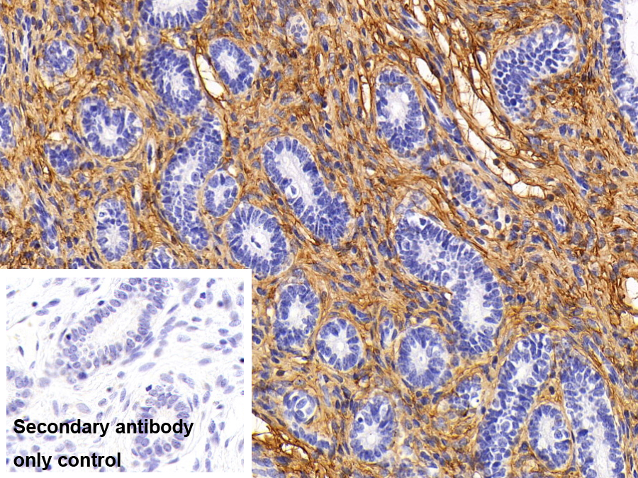 Monoclonal Antibody to Procollagen III N-Terminal Propeptide (PIIINP)