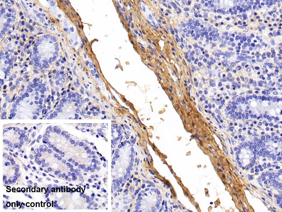 Monoclonal Antibody to Procollagen III N-Terminal Propeptide (PIIINP)