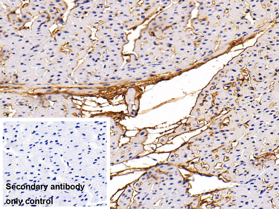 Monoclonal Antibody to Procollagen III N-Terminal Propeptide (PIIINP)