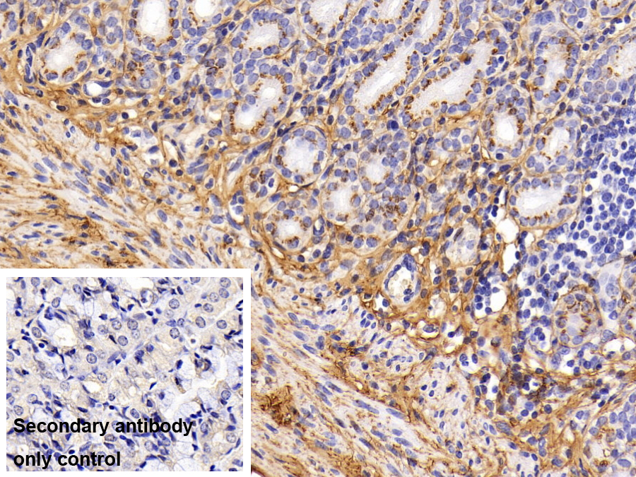 Monoclonal Antibody to Procollagen III N-Terminal Propeptide (PIIINP)