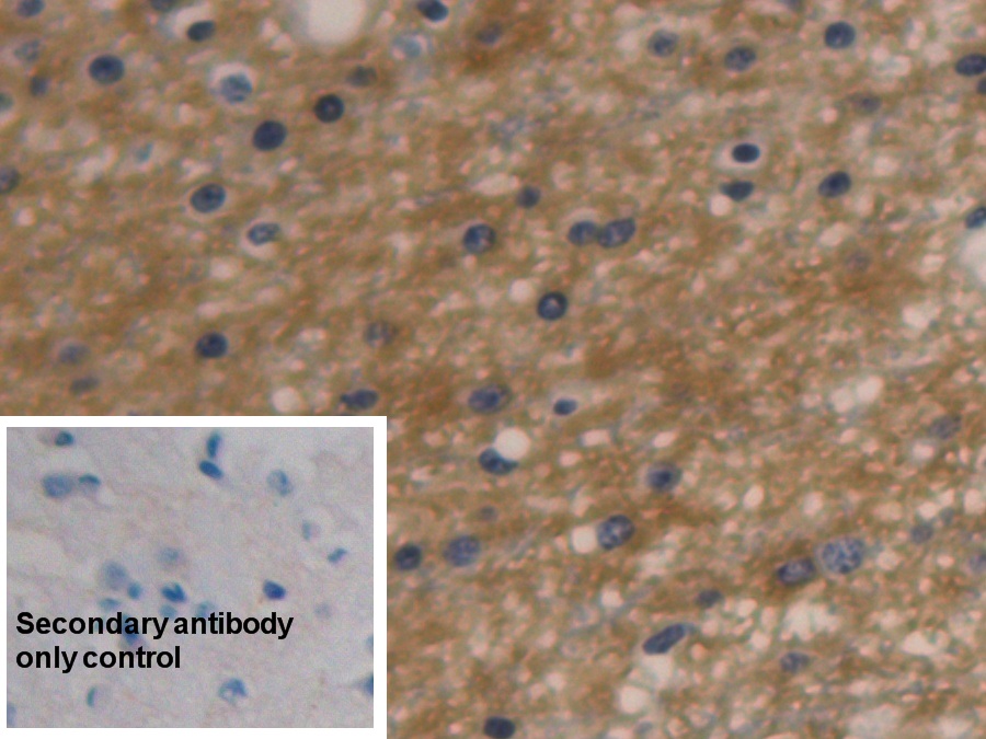 Monoclonal Antibody to Aquaporin 4 (AQP4)