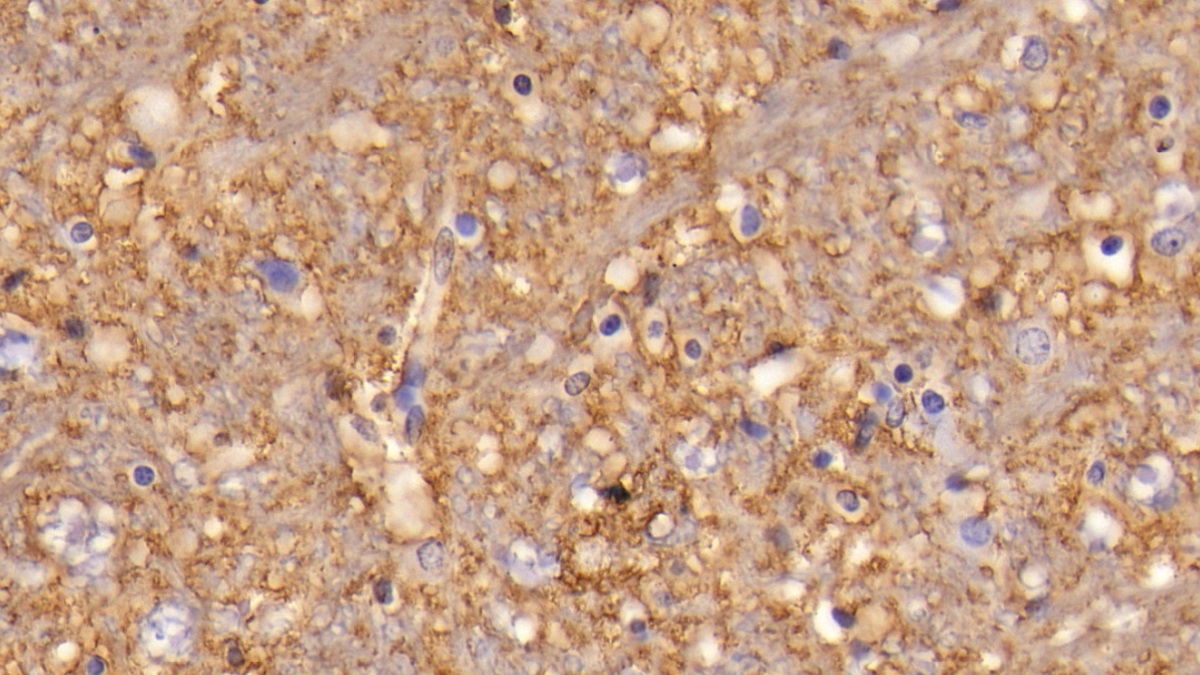 Monoclonal Antibody to Aquaporin 4 (AQP4)