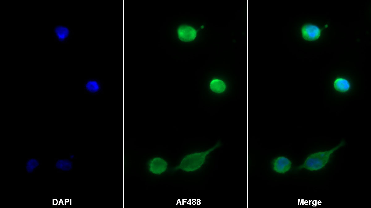 Monoclonal Antibody to Aquaporin 4 (AQP4)