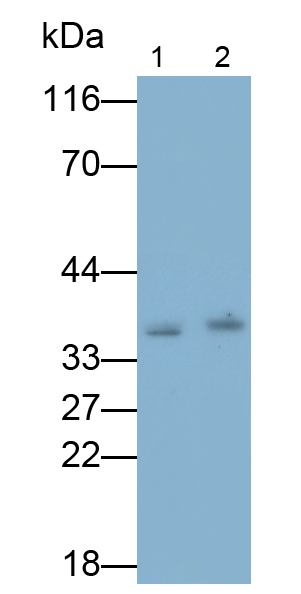Monoclonal Antibody to Cyclin D1 (CCND1)