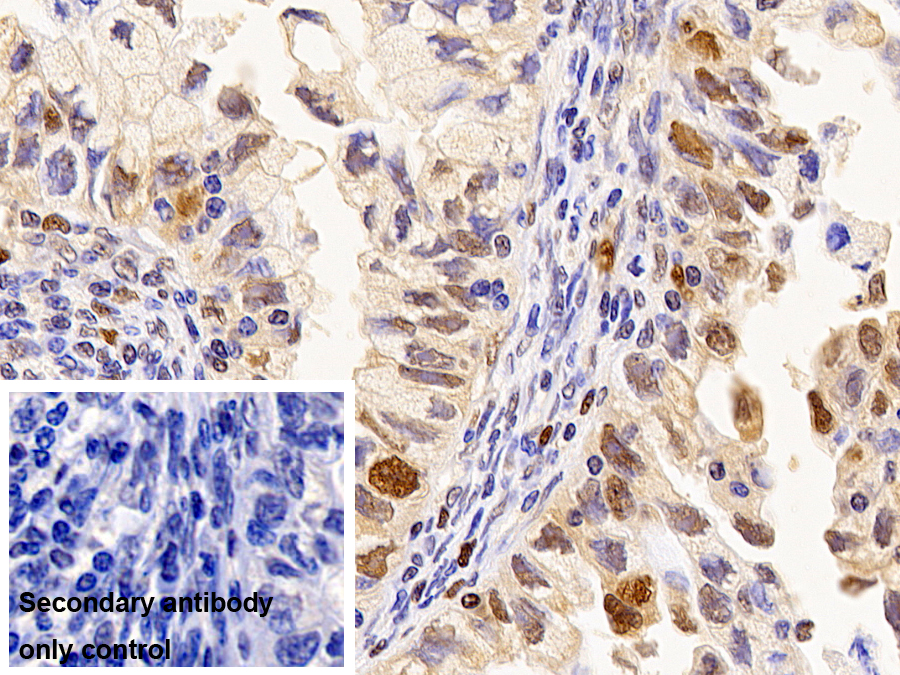 Monoclonal Antibody to Proliferating Cell Nuclear Antigen (PCNA)