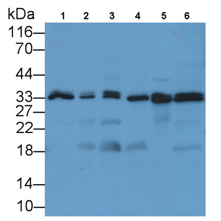 Monoclonal Antibody to Proliferating Cell Nuclear Antigen (PCNA)