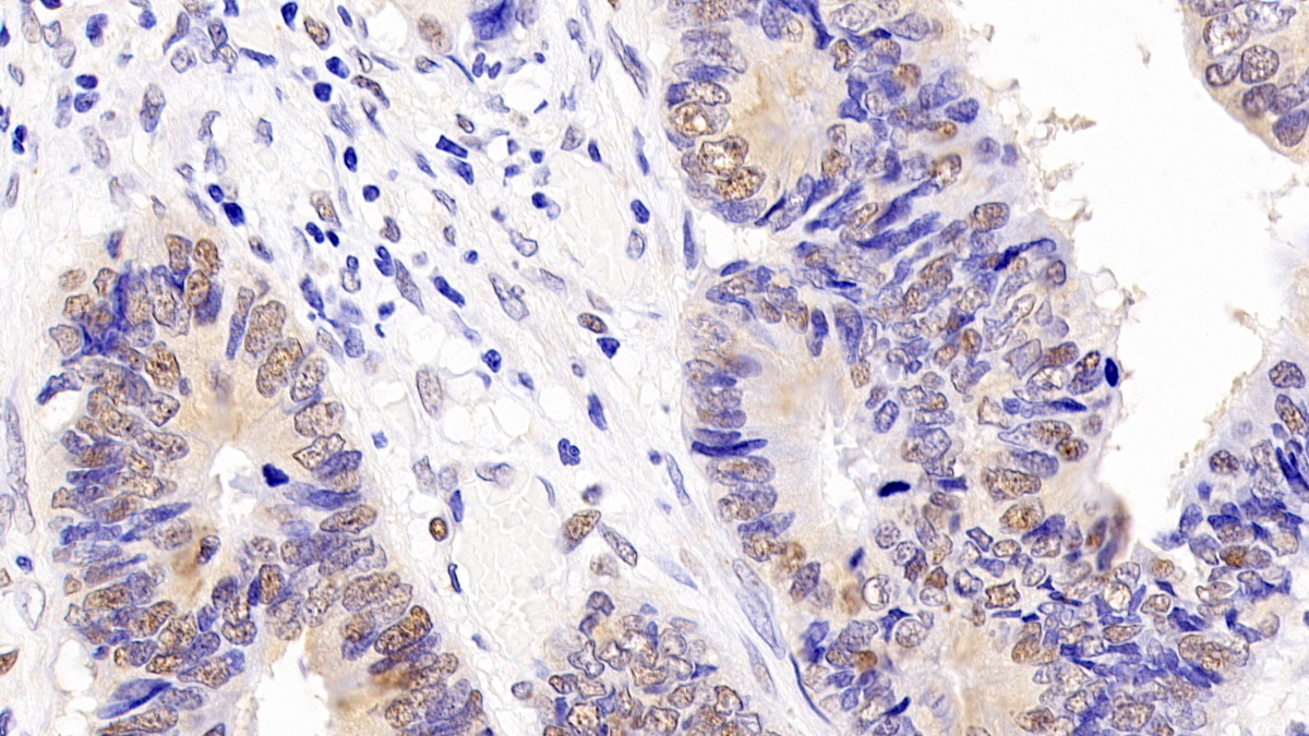 Monoclonal Antibody to Proliferating Cell Nuclear Antigen (PCNA)