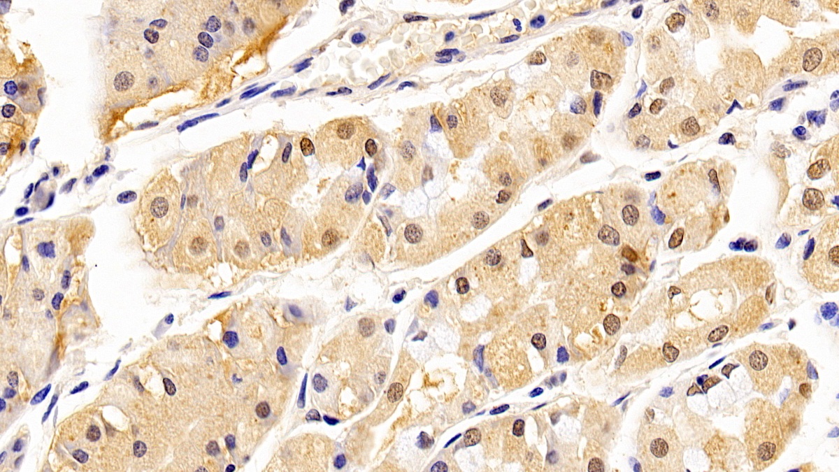 Monoclonal Antibody to Proliferating Cell Nuclear Antigen (PCNA)