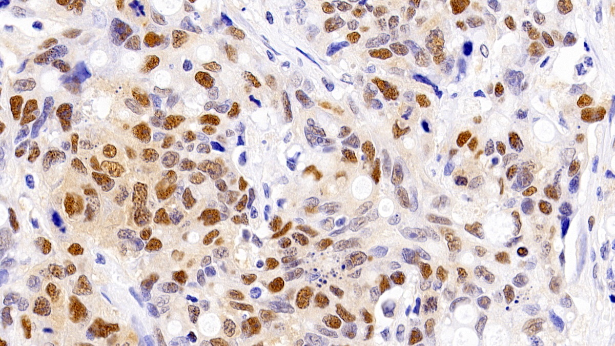 Monoclonal Antibody to Proliferating Cell Nuclear Antigen (PCNA)