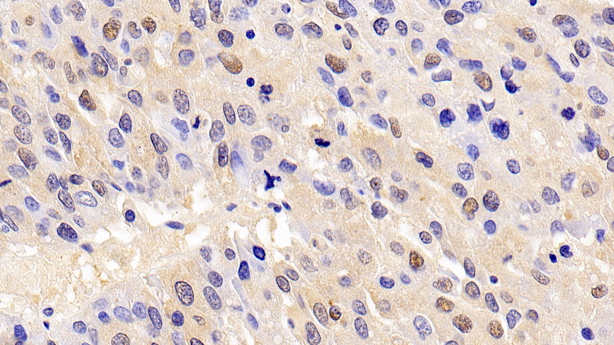 Monoclonal Antibody to Proliferating Cell Nuclear Antigen (PCNA)