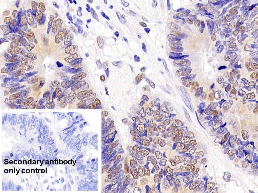 Monoclonal Antibody to Proliferating Cell Nuclear Antigen (PCNA)