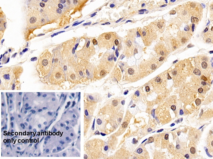 Monoclonal Antibody to Proliferating Cell Nuclear Antigen (PCNA)