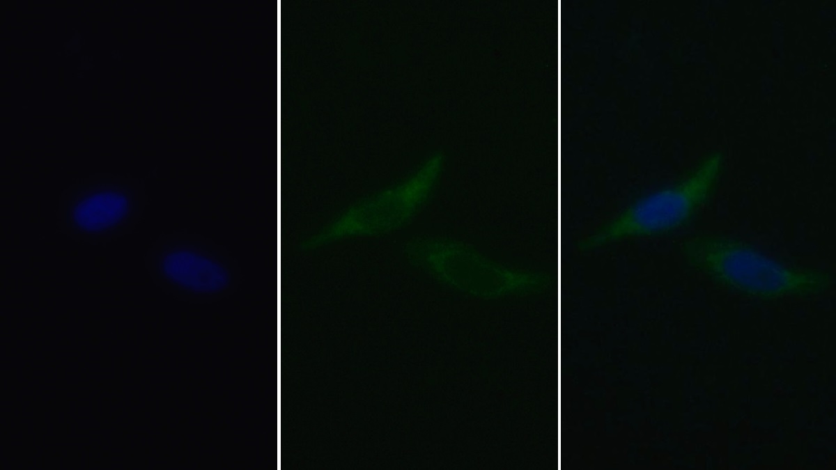 Monoclonal Antibody to Cytochrome C (CYCS)