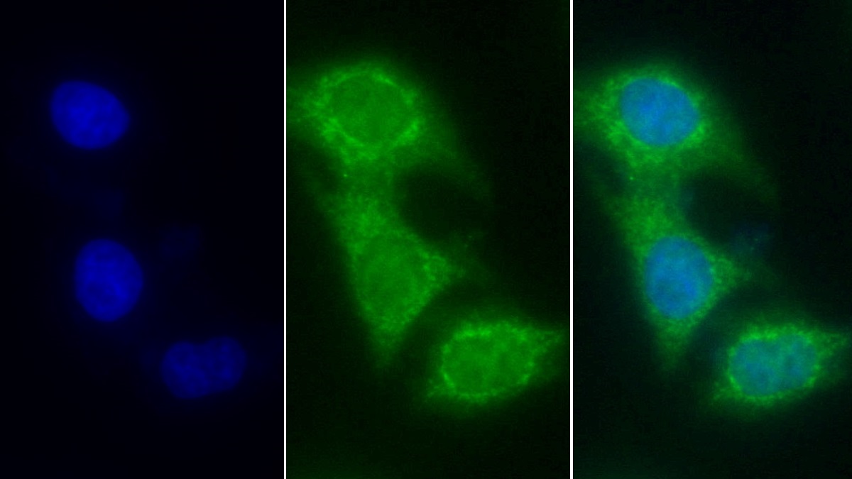 Monoclonal Antibody to Cytochrome C (CYCS)