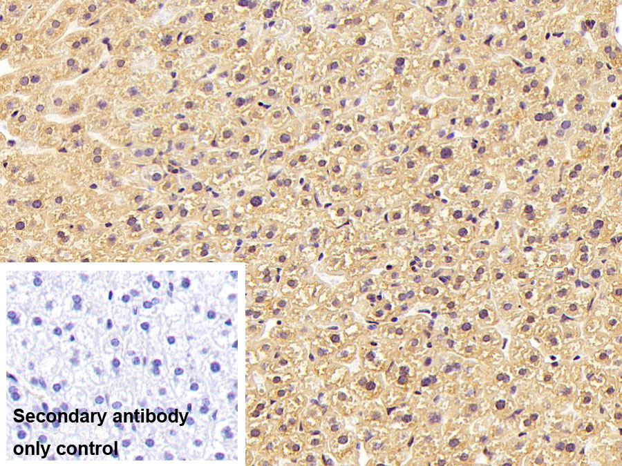 Monoclonal Antibody to Apolipoprotein B100 (APOB100)