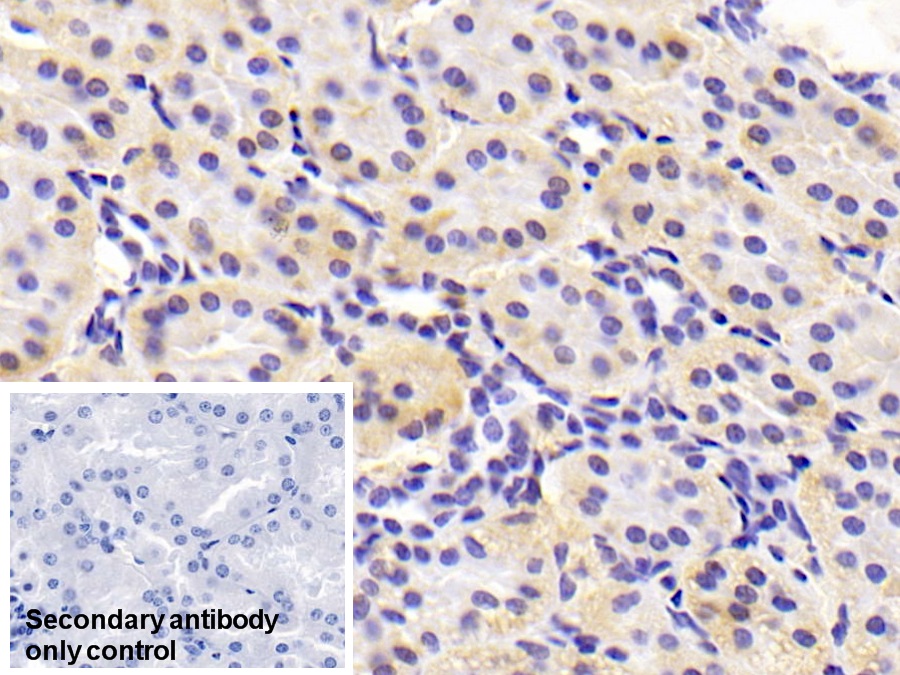 Monoclonal Antibody to Adiponectin (ADPN)