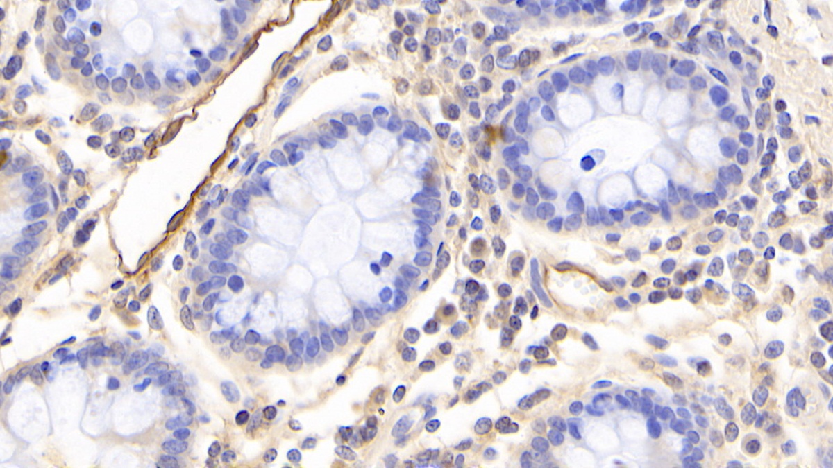 Monoclonal Antibody to Adiponectin (ADPN)