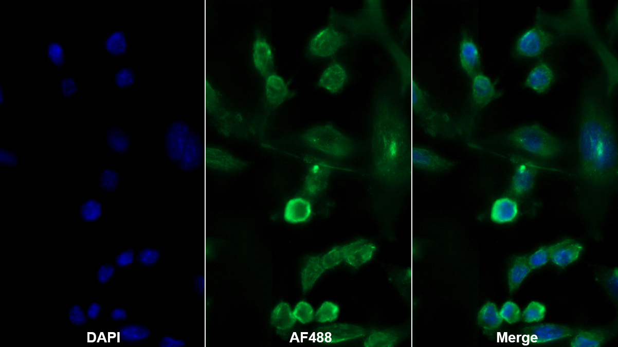 Monoclonal Antibody to Adiponectin (ADPN)