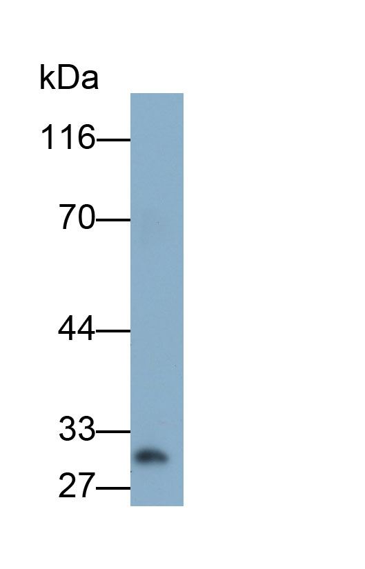 Monoclonal Antibody to Adiponectin (ADPN)