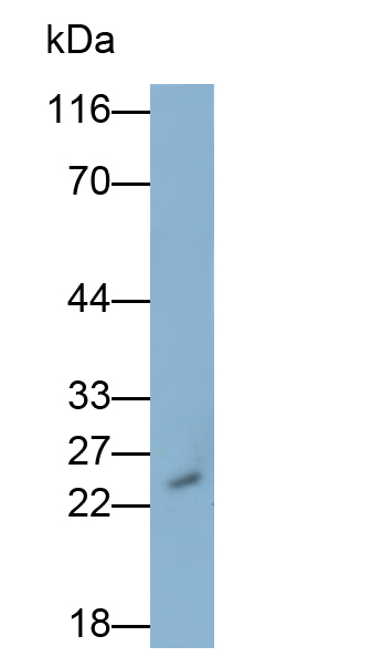 Monoclonal Antibody to Glutathione S Transferase Theta 1 (GSTt1)