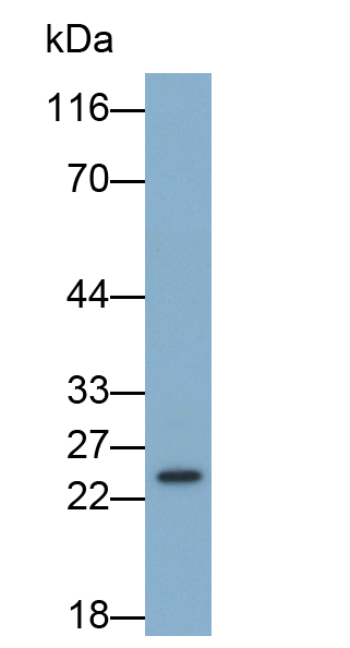 Monoclonal Antibody to Glutathione S Transferase Theta 1 (GSTt1)