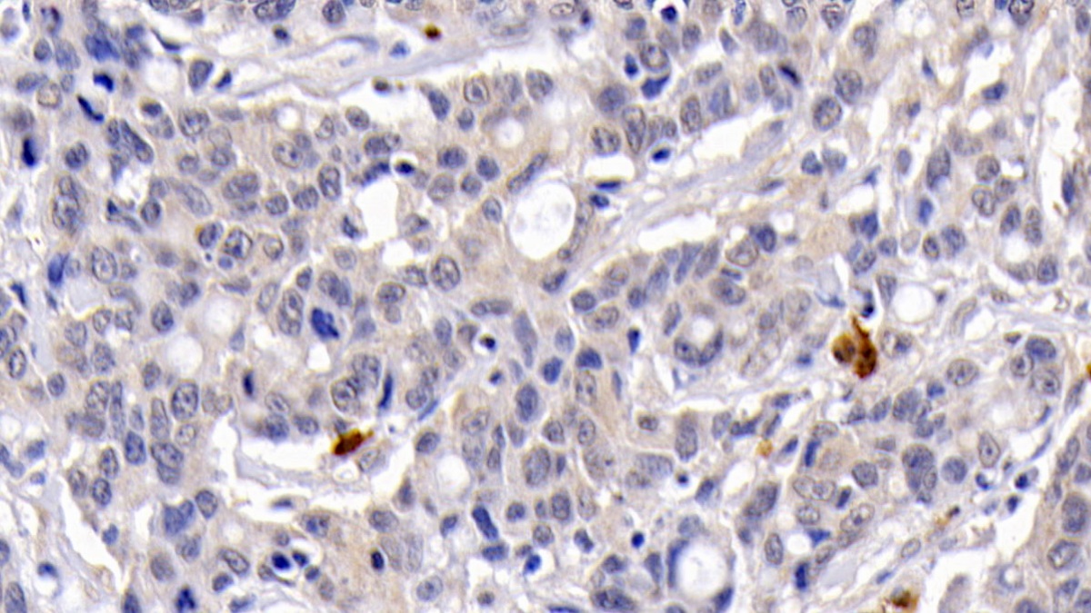 Monoclonal Antibody to Caspase 3 (CASP3)