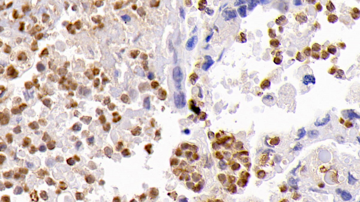 Monoclonal Antibody to Caspase 3 (CASP3)