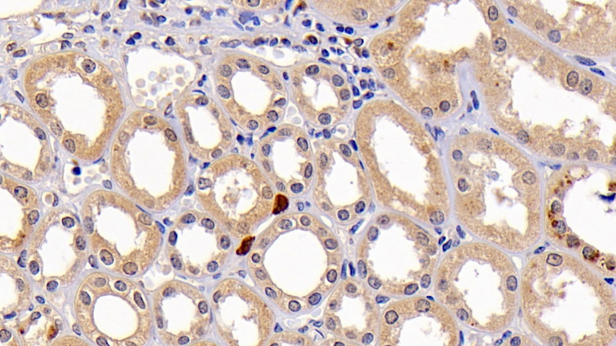 Monoclonal Antibody to Caspase 3 (CASP3)