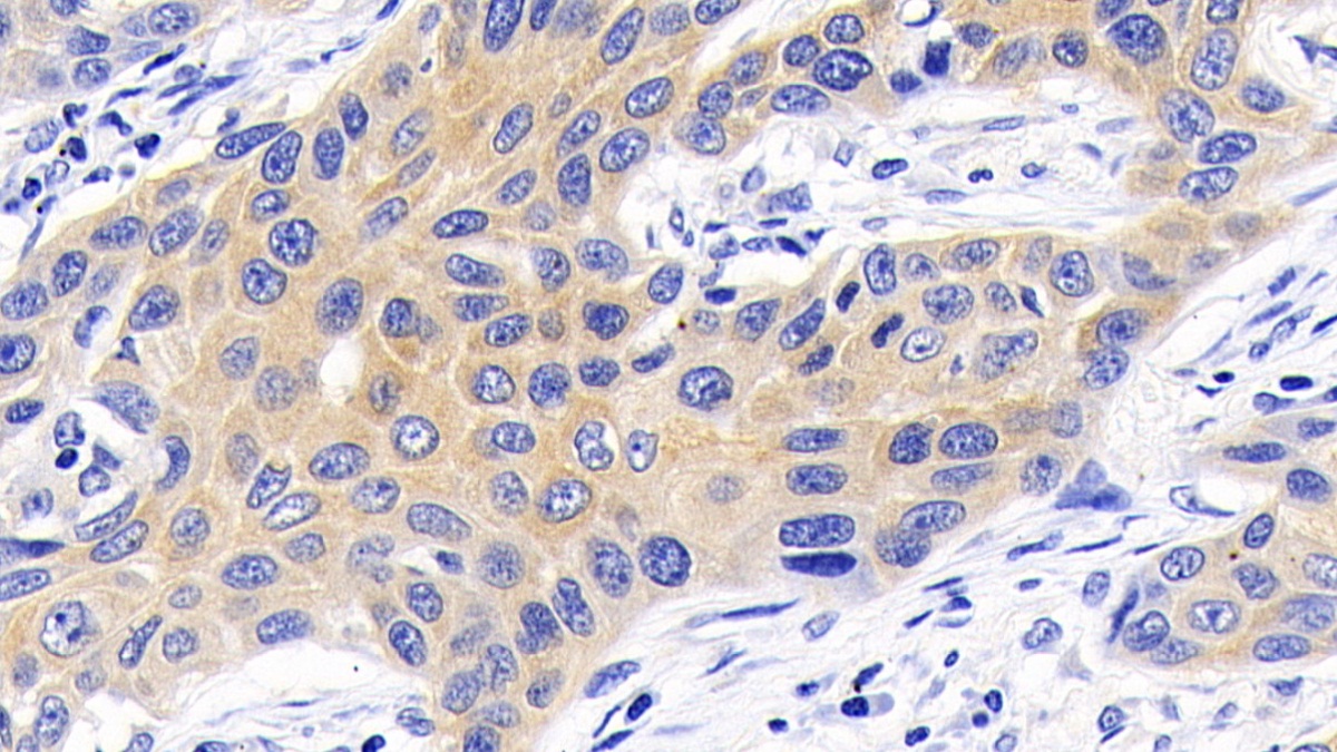 Monoclonal Antibody to Caspase 9 (CASP9)