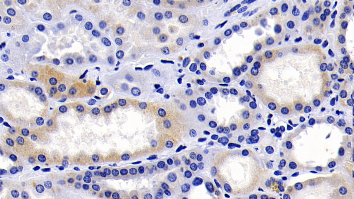 Monoclonal Antibody to Caspase 9 (CASP9)