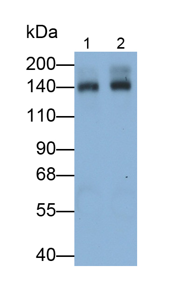 Monoclonal Antibody to Complement Factor H (CFH)