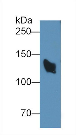 Monoclonal Antibody to Complement Factor H (CFH)